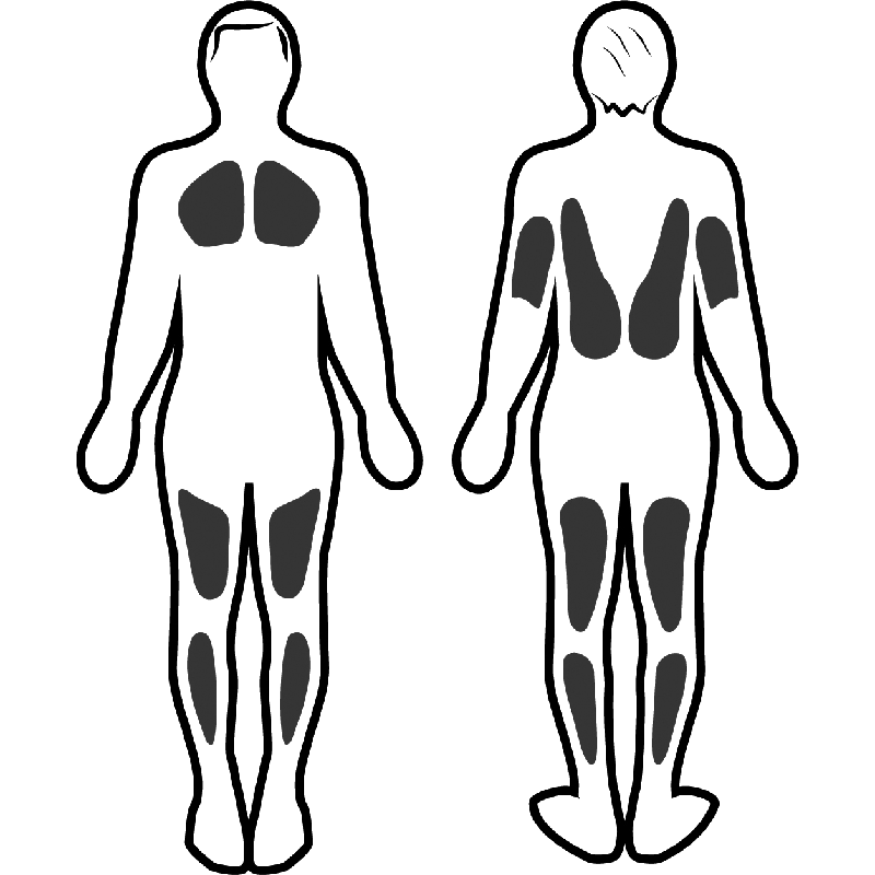 Stimulation musculaire