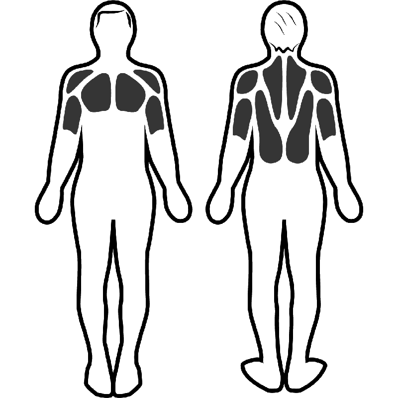 Stimulation musculaire