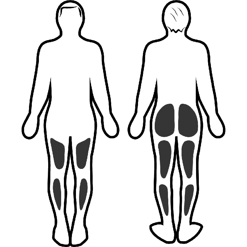 Stimulation musculaire