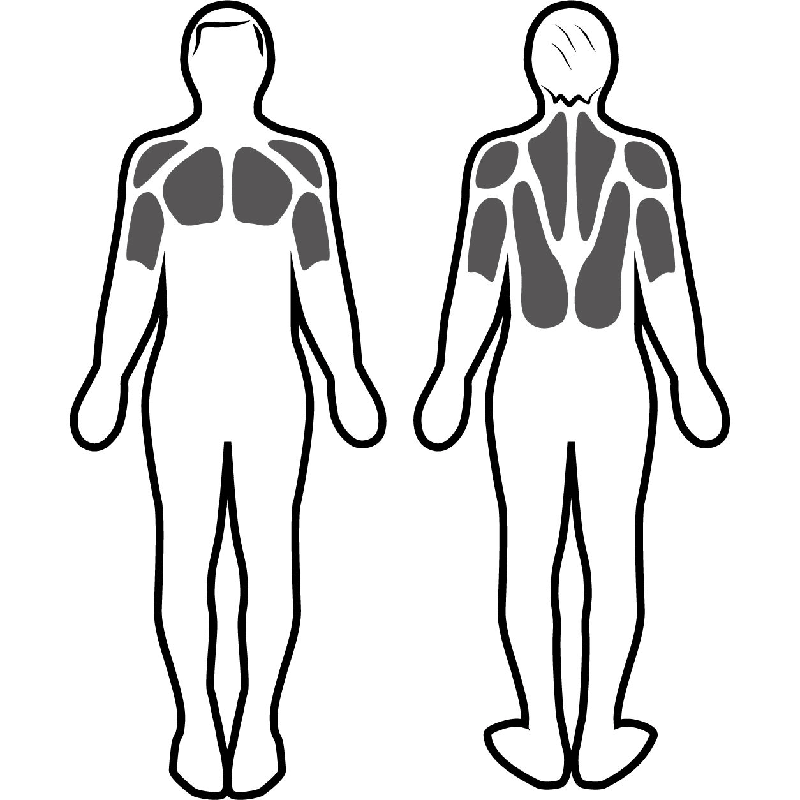 Stimulation musculaire