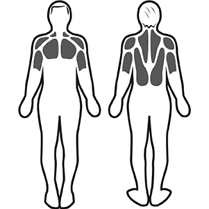 Stimulation musculaire