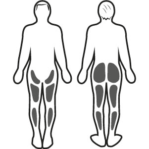 Stimulation musculaire