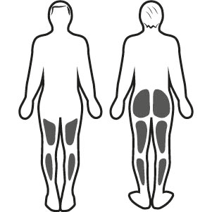 Stimulation musculaire