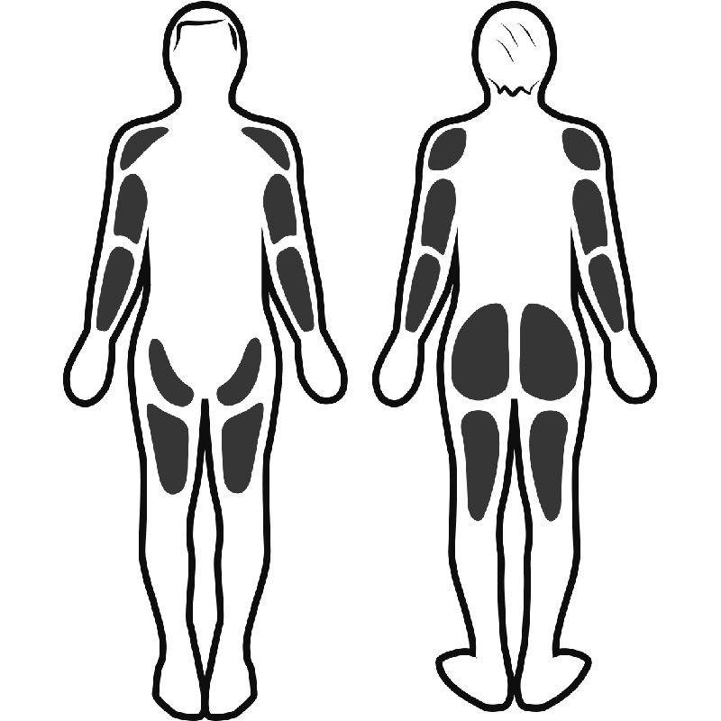 Stimulation musculaire