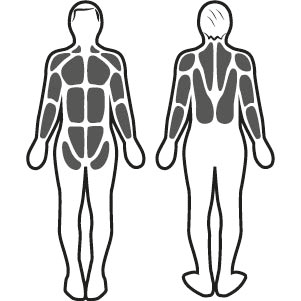 Stimulation musculaire