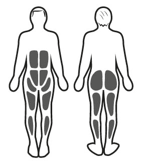 Stimulation musculaire